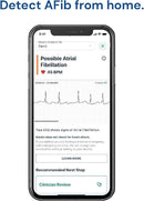 AliveCor KardiaMobile ECG Monitor – Portable EKG Device for Heart Health
