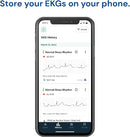 AliveCor KardiaMobile ECG Monitor – Portable EKG Device for Heart Health